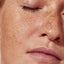 Combatting Hyperpigmentation: Brighten Your Skin with the Right Routine